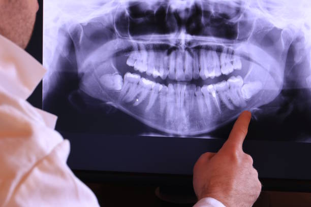 Best Emergency Denture Repair in Hillcrest, CA